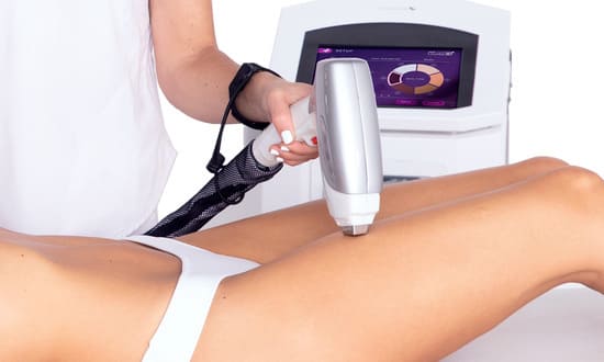 depilacion definitiva proceso 3